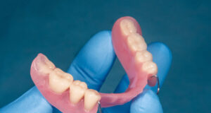 Protezy zębowe – na czym polega naprawa? naprawa protez