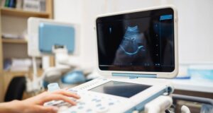 Czy USG ginekologiczne jest bolesne? Jak przygotować się do badania i czego się spodziewać? usg ginekologiczne